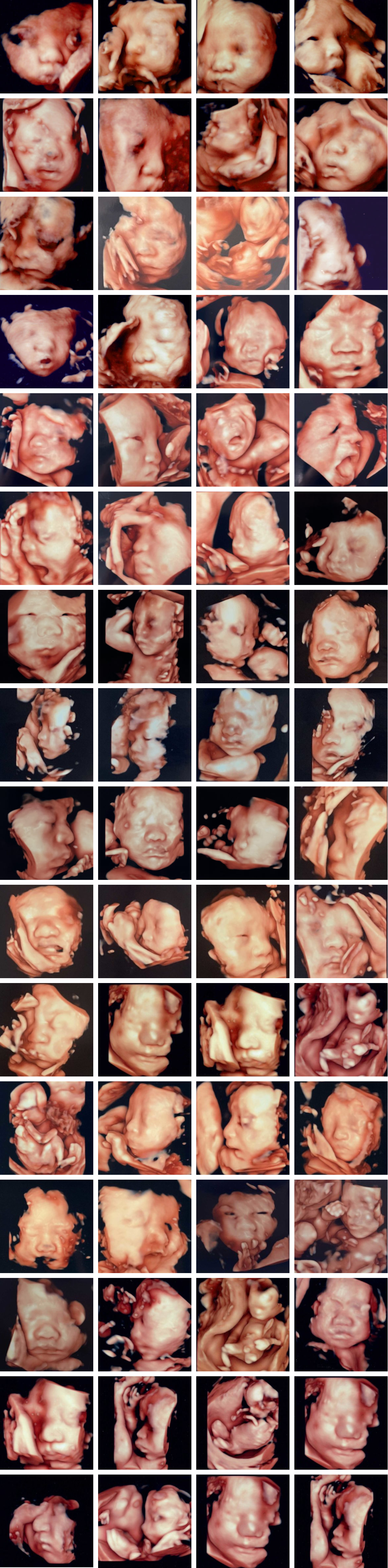 4Dエコーで撮影された赤ちゃんのギャラリー